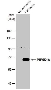 Western blot - Anti-PIP5K1A antibody [HL2011] (AB308218)