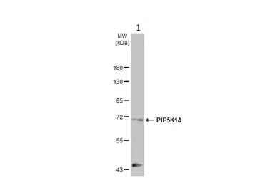 Western blot - Anti-PIP5K1A antibody [HL2011] (AB308218)