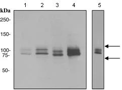 Western blot - Anti-PIP5K1C antibody [MAO-R1] (AB109192)