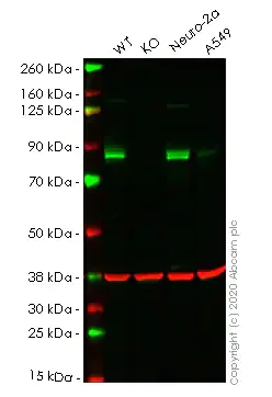 Western blot - Anti-PIP5K1C antibody [MAO-R1] (AB109192)