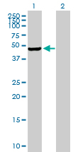 Western blot - Anti-PIP5K2 gamma antibody (AB169572)