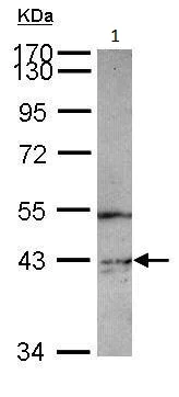 Western blot - Anti-PIP5K2 gamma antibody - N-terminal (AB228894)