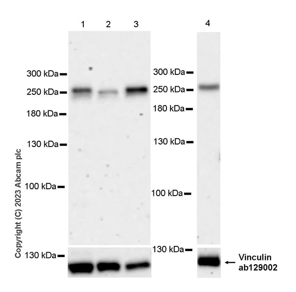 Western blot - Anti-PIP5K3/PIKFYVE antibody [EPR27944-21] - BSA and Azide free (AB315091)