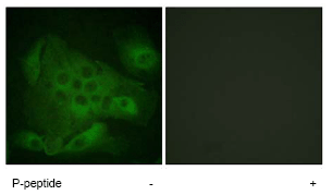 Immunocytochemistry/ Immunofluorescence - Anti-PIP5K3/PIKFYVE (phospho S307) antibody (AB62467)