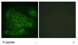 Immunocytochemistry/ Immunofluorescence - Anti-PIP5K3/PIKFYVE (phospho S307) antibody (AB62467)