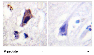 Immunohistochemistry (Formalin/PFA-fixed paraffin-embedded sections) - Anti-PIP5K3/PIKFYVE (phospho S307) antibody (AB62467)