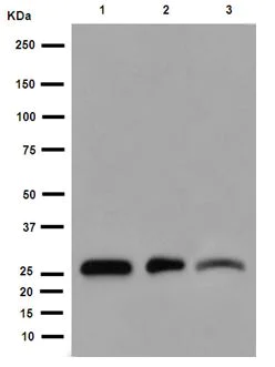 Western blot - Anti-Pirh2 antibody [EPR14980] (AB189247)