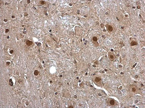 Immunohistochemistry (Formalin/PFA-fixed paraffin-embedded sections) - Anti-Pirin/PIR antibody (AB227280)