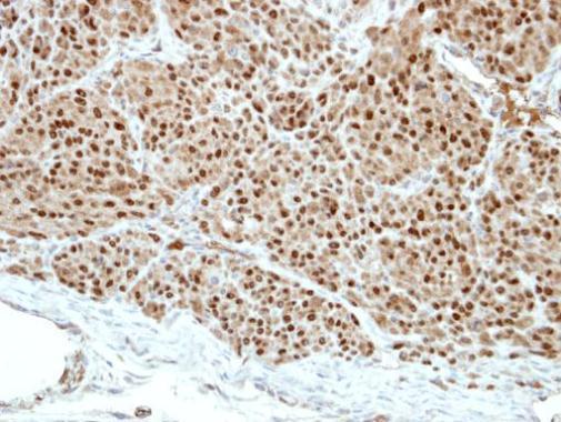 Immunohistochemistry (Formalin/PFA-fixed paraffin-embedded sections) - Anti-Pirin/PIR antibody (AB227280)