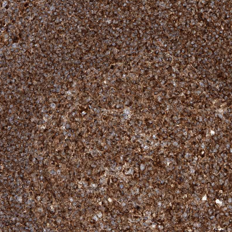 Immunohistochemistry (Formalin/PFA-fixed paraffin-embedded sections) - Anti-PISD antibody (AB262867)