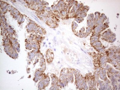 Immunohistochemistry (Formalin/PFA-fixed paraffin-embedded sections) - Anti-PISD antibody [OTI4G5] (AB236405)
