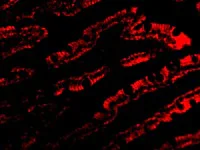 Immunocytochemistry - Anti-PIST antibody (AB37036)