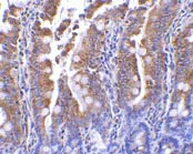 Immunohistochemistry (Formalin/PFA-fixed paraffin-embedded sections) - Anti-PIST antibody (AB37036)