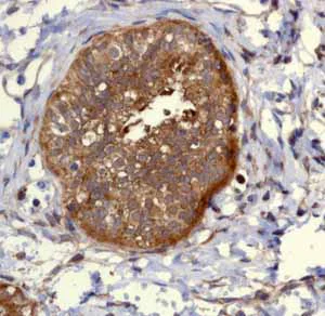 Immunohistochemistry (Formalin/PFA-fixed paraffin-embedded sections) - Anti-PIST antibody [EPR4079] (AB109119)