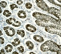 Immunohistochemistry (Formalin/PFA-fixed paraffin-embedded sections) - Anti-PIST antibody [EPR4079] (AB109119)