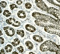 Immunohistochemistry (Formalin/PFA-fixed paraffin-embedded sections) - Anti-PIST antibody [EPR4079] (AB109119)