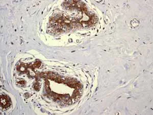 Immunohistochemistry (Formalin/PFA-fixed paraffin-embedded sections) - Anti-PIST antibody [EPR4079] (AB109119)