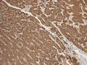 Immunohistochemistry (Formalin/PFA-fixed paraffin-embedded sections) - Anti-PIST antibody [EPR4079] (AB109119)