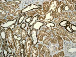 Immunohistochemistry (Formalin/PFA-fixed paraffin-embedded sections) - Anti-PIST antibody [EPR4079] (AB109119)