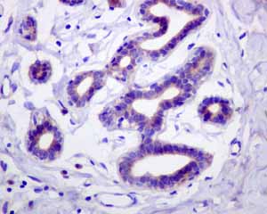 Immunohistochemistry (Formalin/PFA-fixed paraffin-embedded sections) - Anti-PIST antibody [EPR4080(2)] - BSA and Azide free (AB248513), expandable thumbnail