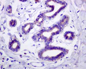 Immunohistochemistry (Formalin/PFA-fixed paraffin-embedded sections) - Anti-PIST antibody [EPR4080(2)] - BSA and Azide free (AB248513)