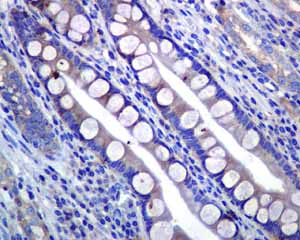 Immunohistochemistry (Formalin/PFA-fixed paraffin-embedded sections) - Anti-PIST antibody [EPR4080(2)] - BSA and Azide free (AB248513), expandable thumbnail