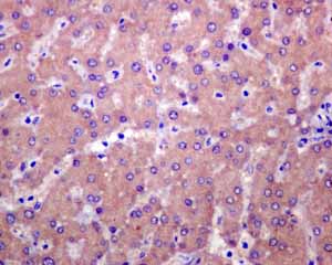 Immunohistochemistry (Formalin/PFA-fixed paraffin-embedded sections) - Anti-PIST antibody [EPR4080(2)] - BSA and Azide free (AB248513), expandable thumbnail