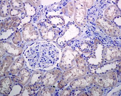 Immunohistochemistry (Formalin/PFA-fixed paraffin-embedded sections) - Anti-PIST antibody [EPR4080(2)] - BSA and Azide free (AB248513), expandable thumbnail