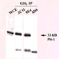 Immunoprecipitation - Anti-Pit1 antibody [5E4] (AB10545)