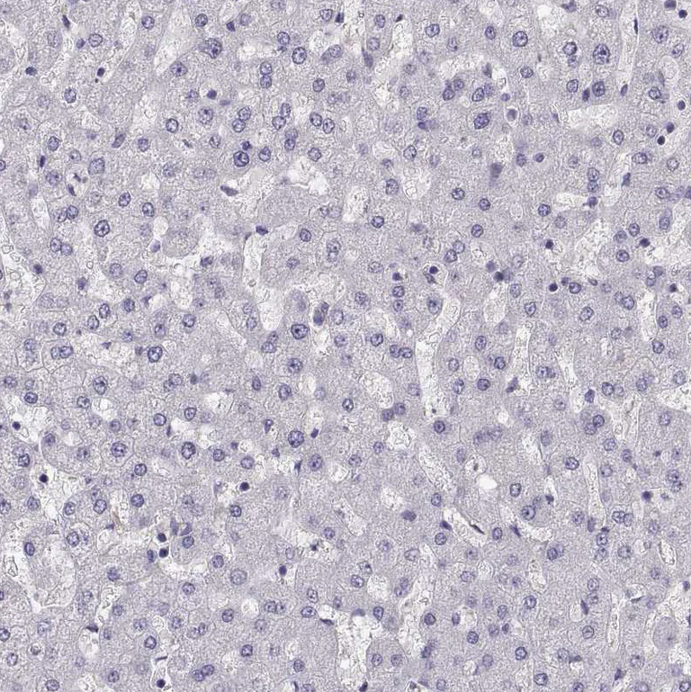 Immunohistochemistry (Formalin/PFA-fixed paraffin-embedded sections) - Anti-Pit1 antibody (AB272639)