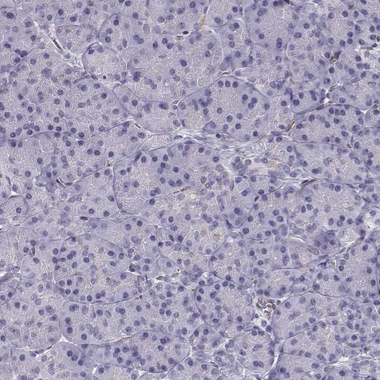 Immunohistochemistry (Formalin/PFA-fixed paraffin-embedded sections) - Anti-Pit1 antibody (AB272639)