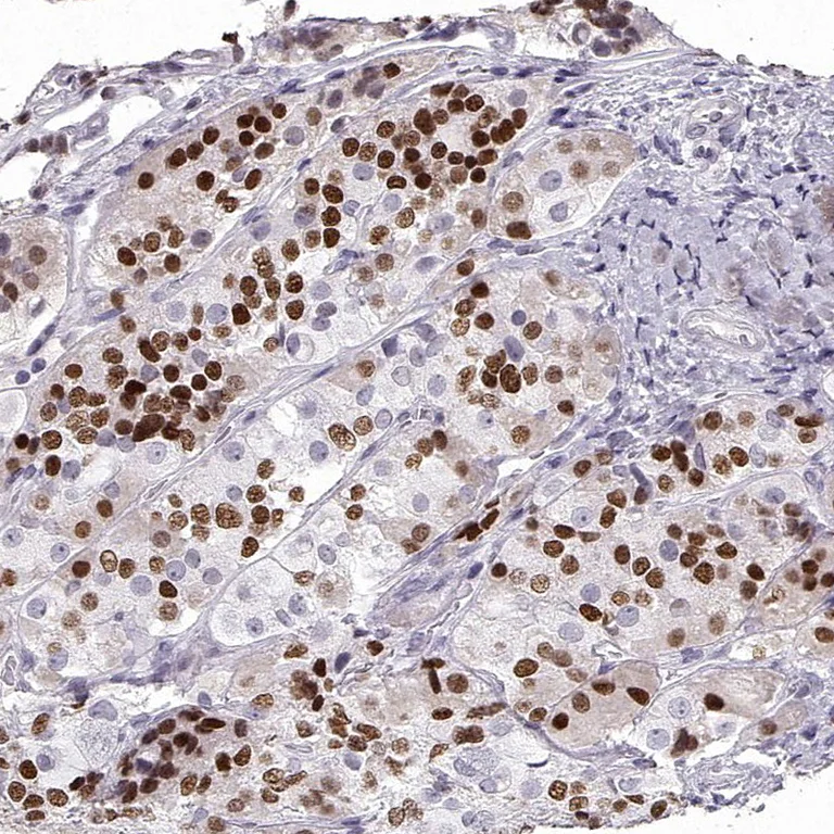 Immunohistochemistry (Formalin/PFA-fixed paraffin-embedded sections) - Anti-Pit1 antibody (AB272639)