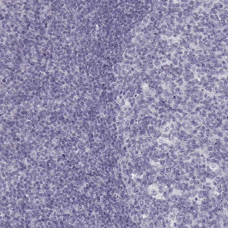 Immunohistochemistry (Formalin/PFA-fixed paraffin-embedded sections) - Anti-Pit1 antibody (AB272639)