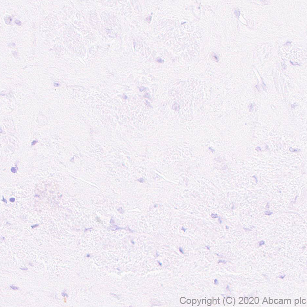 Immunohistochemistry (Formalin/PFA-fixed paraffin-embedded sections) - Anti-Pit1 antibody [EPR23555-203] (ab273048), expandable thumbnail