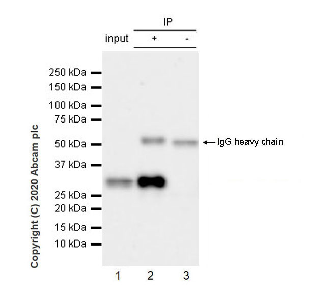 Immunoprecipitation - Anti-Pit1 antibody [EPR23555-203] (AB273048), expandable thumbnail