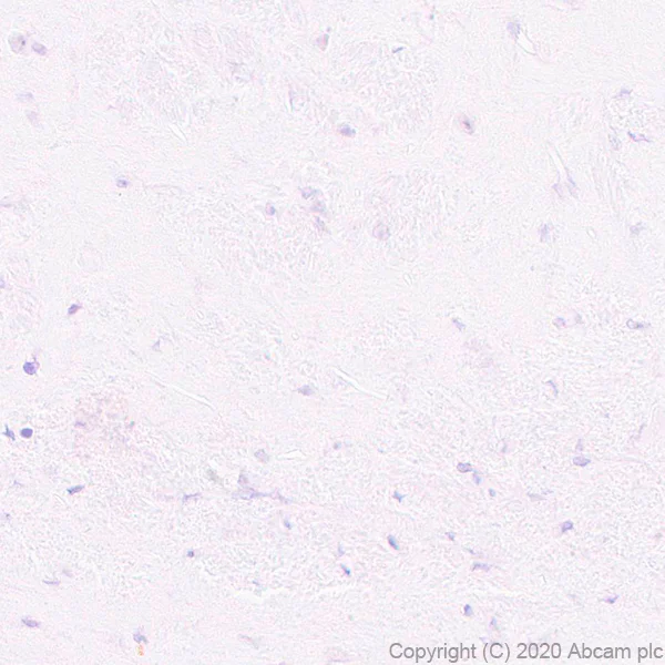 Immunohistochemistry (Formalin/PFA-fixed paraffin-embedded sections) - Anti-Pit1 antibody [EPR23555-203] - BSA and Azide free (AB273057)