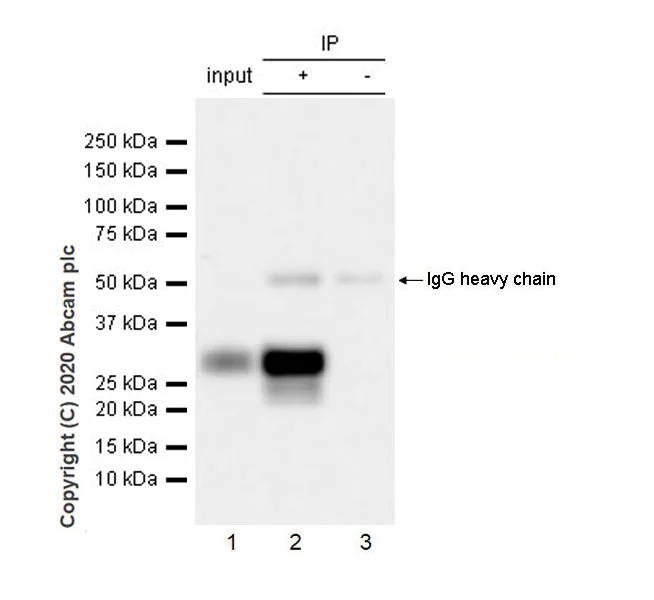 Immunoprecipitation - Anti-Pit1 antibody [EPR23555-203] - BSA and Azide free (AB273057)