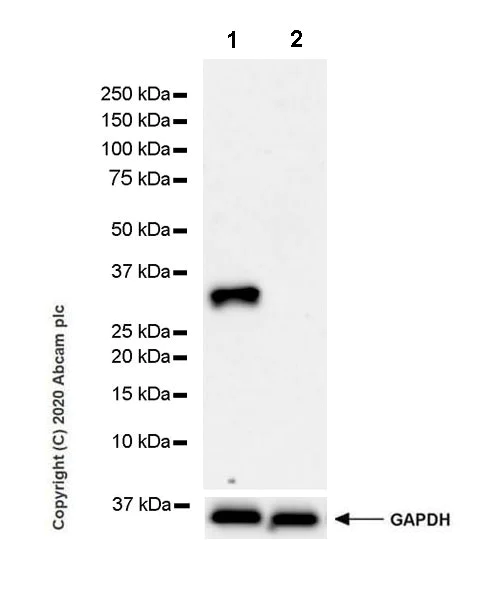Western blot - Anti-Pit1 antibody [EPR23555-203] - BSA and Azide free (AB273057)
