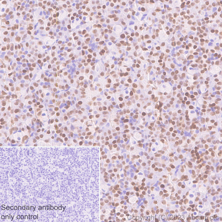 Immunohistochemistry (Formalin/PFA-fixed paraffin-embedded sections) - Anti-Pit1 antibody [EPR28191-52] - BSA and Azide free (ab313643), expandable thumbnail