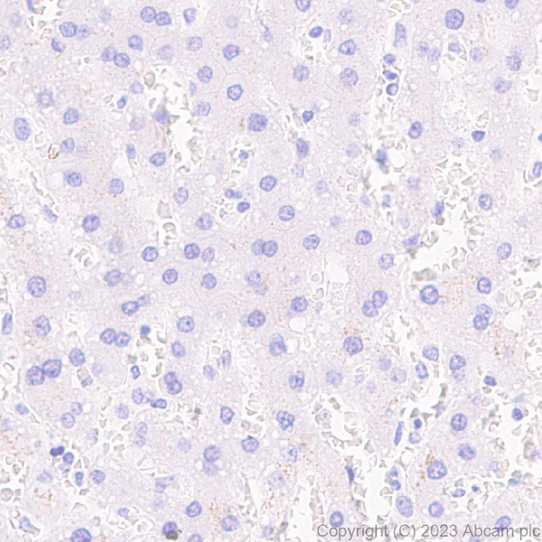 Immunohistochemistry (Formalin/PFA-fixed paraffin-embedded sections) - Anti-Pit1 antibody [EPR28191-52] - BSA and Azide free (AB313643)
