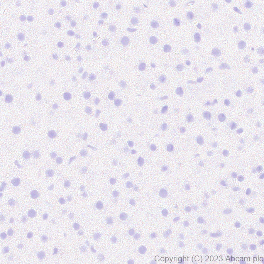 Immunohistochemistry (Formalin/PFA-fixed paraffin-embedded sections) - Anti-Pit1 antibody [EPR28191-52] - BSA and Azide free (AB313643), expandable thumbnail