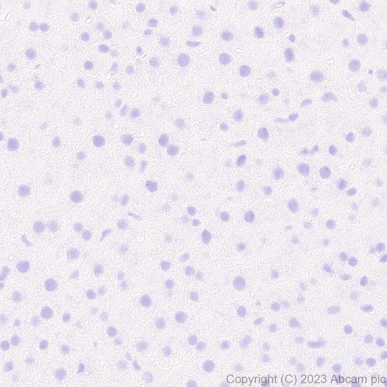 Immunohistochemistry (Formalin/PFA-fixed paraffin-embedded sections) - Anti-Pit1 antibody [EPR28191-52] - BSA and Azide free (AB313643)