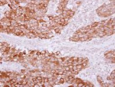 Immunohistochemistry (Formalin/PFA-fixed paraffin-embedded sections) - Anti-PITPNB antibody (AB127563)