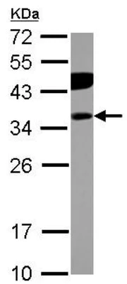 Western blot - Anti-PITPNB antibody (AB127563)