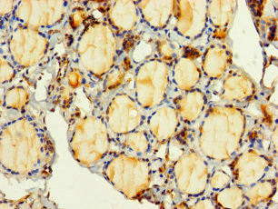 Immunohistochemistry (Formalin/PFA-fixed paraffin-embedded sections) - Anti-PITPNC1 antibody (AB238643), expandable thumbnail