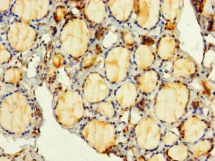 Immunohistochemistry (Formalin/PFA-fixed paraffin-embedded sections) - Anti-PITPNC1 antibody (AB238643)