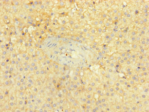 Immunohistochemistry (Formalin/PFA-fixed paraffin-embedded sections) - Anti-PITPNC1 antibody (AB238643), expandable thumbnail