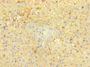 Immunohistochemistry (Formalin/PFA-fixed paraffin-embedded sections) - Anti-PITPNC1 antibody (AB238643)
