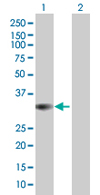 Western blot - Anti-PITPNC1 antibody (AB68013)