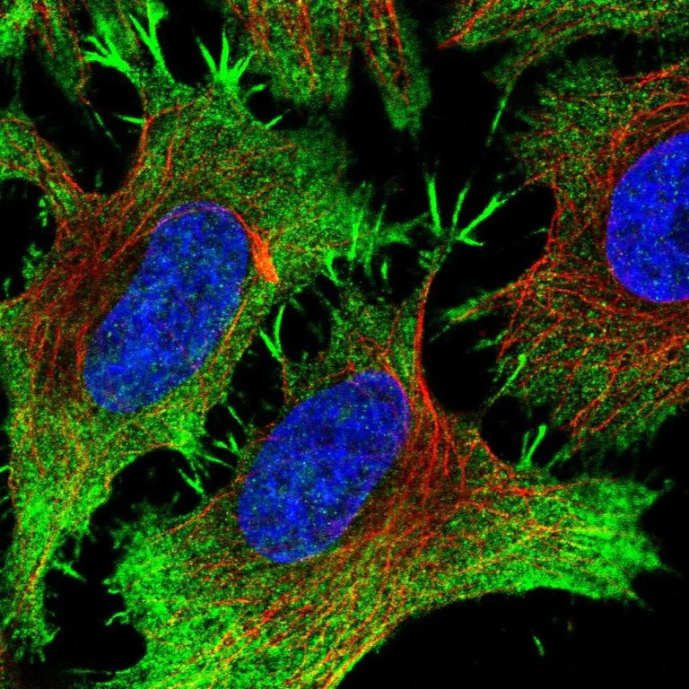 Immunocytochemistry/ Immunofluorescence - Anti-PITPnm 3 antibody (AB251739)